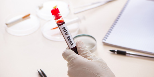 test hiv aids