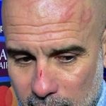 Guardiola shock, graffi e segni sul viso dopo il pareggio: “Voglio farmi del male”