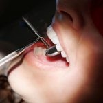 Acqua, bevi sempre la quantità consigliata dai dentisti: perdi tutti i denti se non lo fai, la scoperta lascia pietrificati